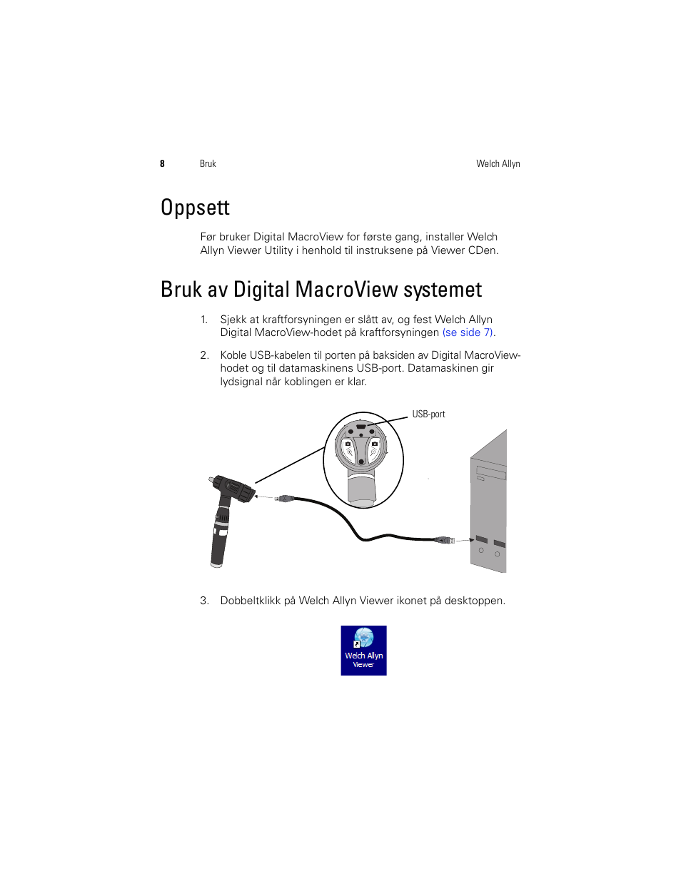Oppsett, Bruk av digital macroview systemet, Oppsett bruk av digital macroview systemet | Welch Allyn Digital MacroView Otoscope - User Manual User Manual | Page 306 / 476