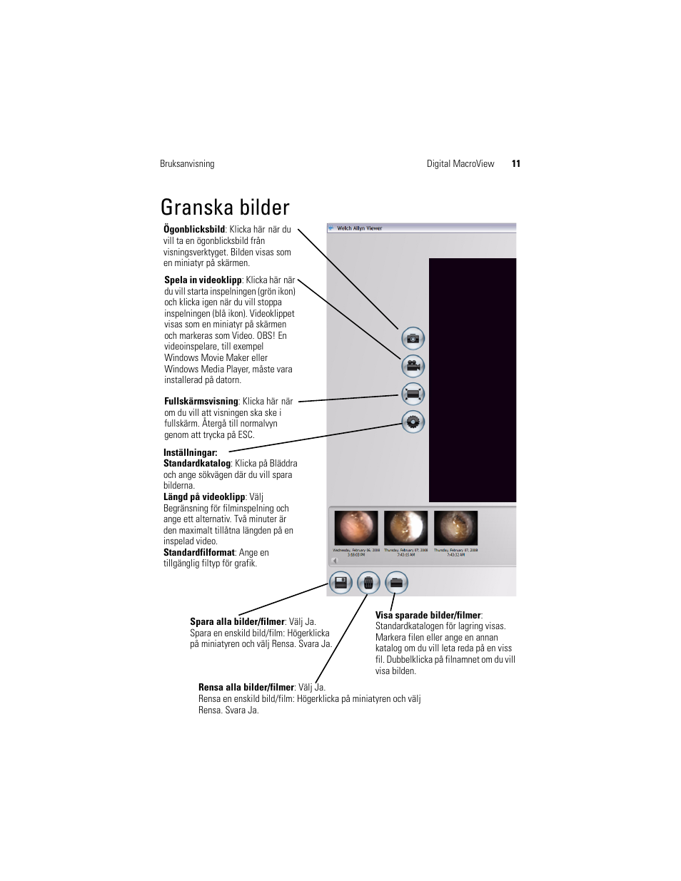 Granska bilder | Welch Allyn Digital MacroView Otoscope - User Manual User Manual | Page 341 / 476