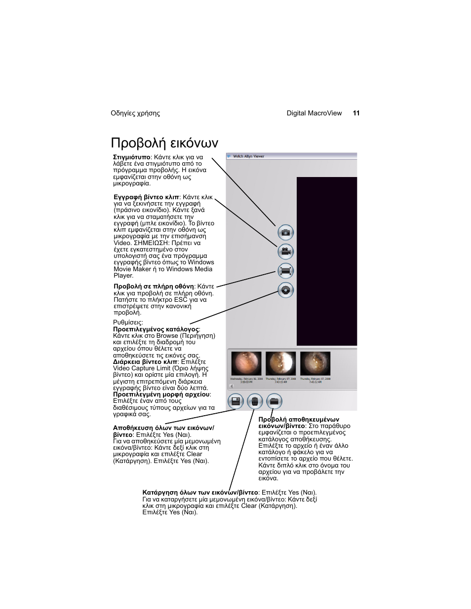 Προβολή εικόνων | Welch Allyn Digital MacroView Otoscope - User Manual User Manual | Page 373 / 476