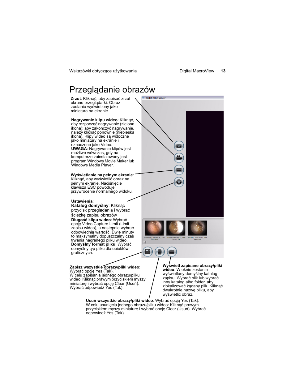 Przegl¶danie obrazów, Przeglądanie obrazów | Welch Allyn Digital MacroView Otoscope - User Manual User Manual | Page 407 / 476