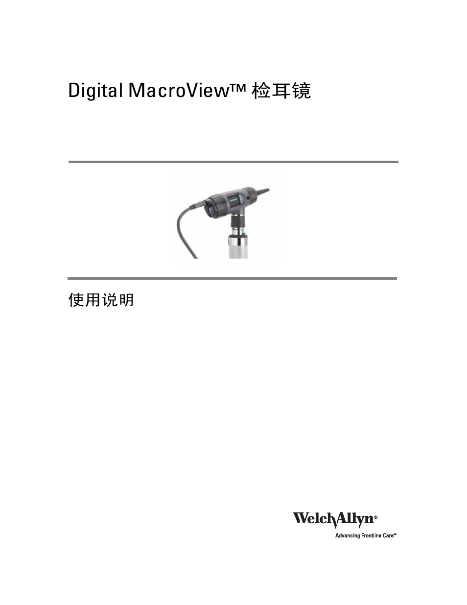 Digital macroview™ 检耳镜 | Welch Allyn Digital MacroView Otoscope - User Manual User Manual | Page 423 / 476