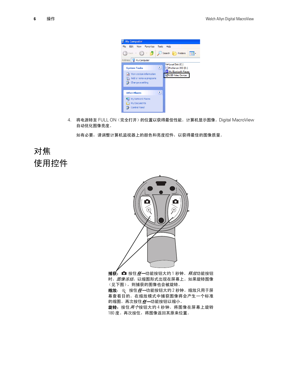 使用控件, 对焦 使用控件 | Welch Allyn Digital MacroView Otoscope - User Manual User Manual | Page 432 / 476