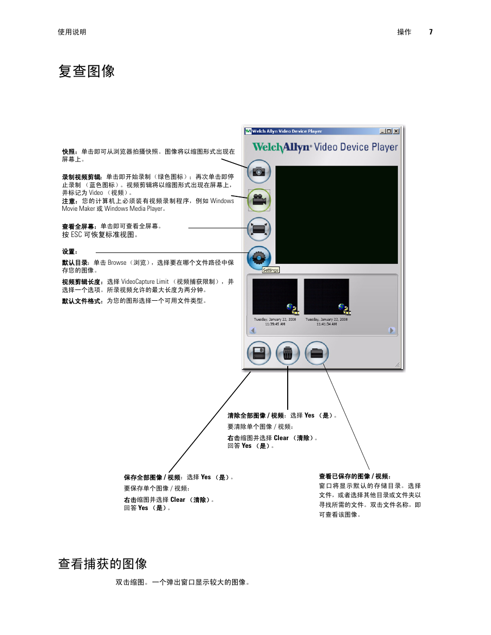 复查图像, 查看捕获的图像 | Welch Allyn Digital MacroView Otoscope - User Manual User Manual | Page 433 / 476