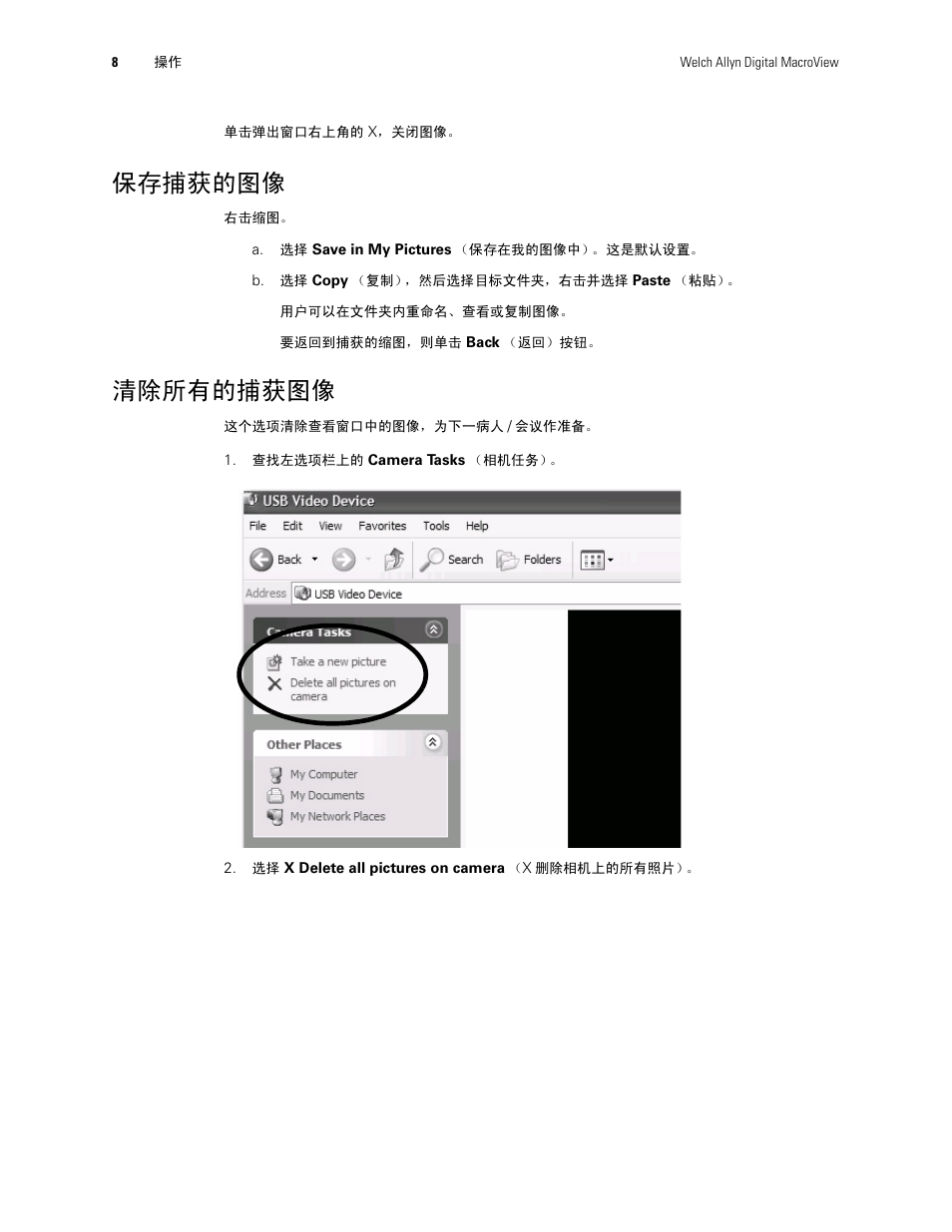 保存捕获的图像, 清除所有的捕获图像 | Welch Allyn Digital MacroView Otoscope - User Manual User Manual | Page 434 / 476