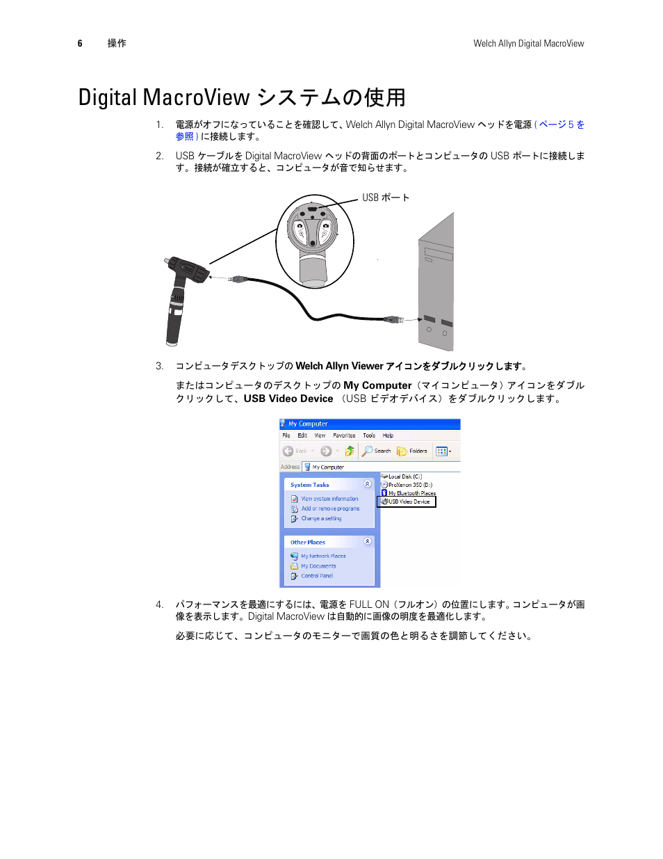 Digital macroview システムの使用, Digital macroview, システムの使用 | Welch Allyn Digital MacroView Otoscope - User Manual User Manual | Page 456 / 476