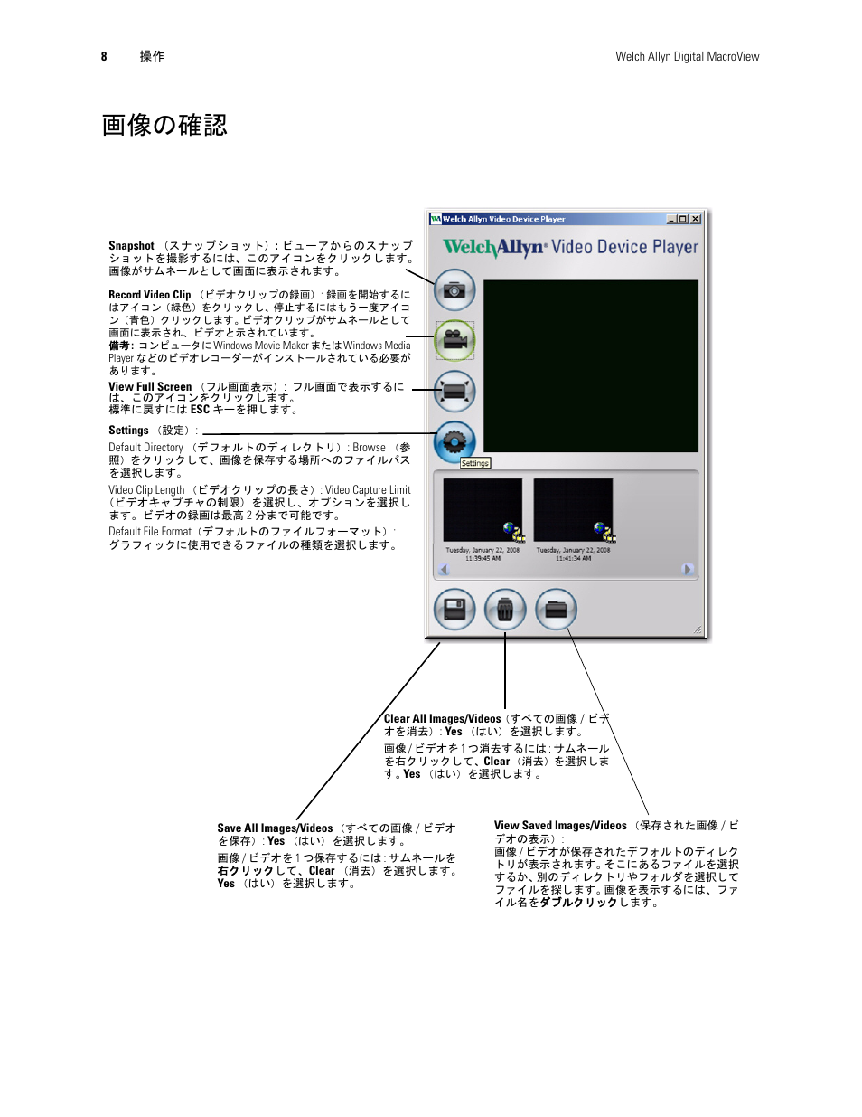 画像の確認 | Welch Allyn Digital MacroView Otoscope - User Manual User Manual | Page 458 / 476