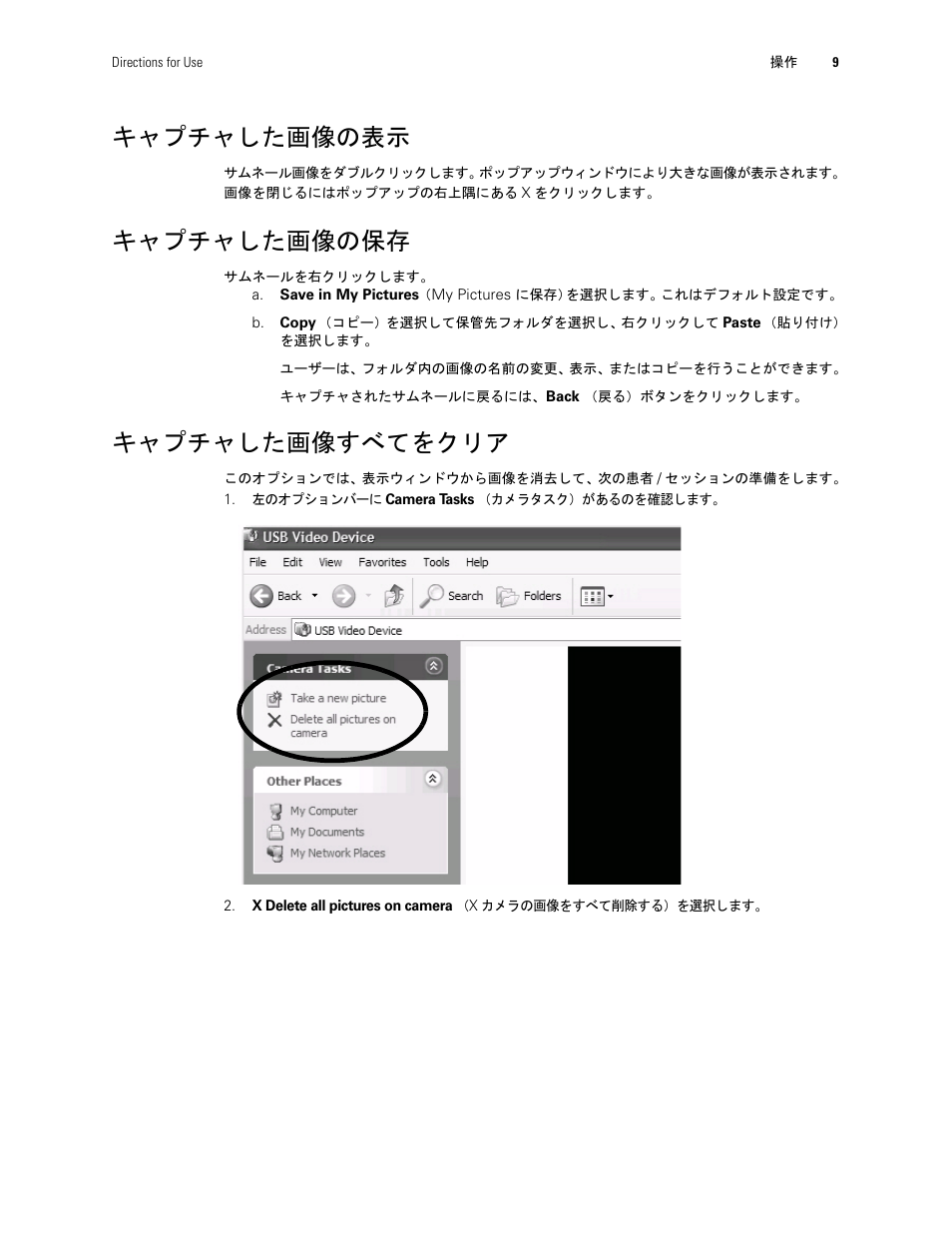 キャプチャした画像の表示, キャプチャした画像の保存, キャプチャした画像すべてをクリア | Welch Allyn Digital MacroView Otoscope - User Manual User Manual | Page 459 / 476