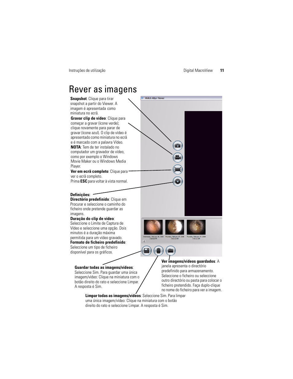 Rever as imagens | Welch Allyn Digital MacroView Otoscope - User Manual User Manual | Page 83 / 476
