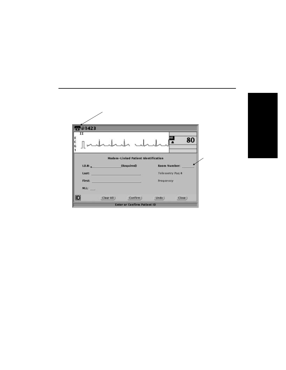 English | Welch Allyn Modem-Propaq - Quick Reference Guide User Manual | Page 17 / 52
