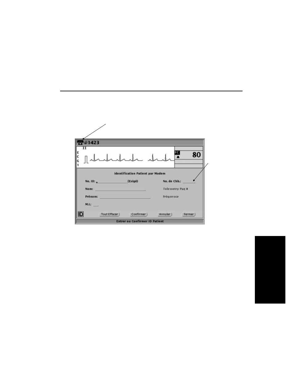 Fran ç ais | Welch Allyn Modem-Propaq - Quick Reference Guide User Manual | Page 49 / 52