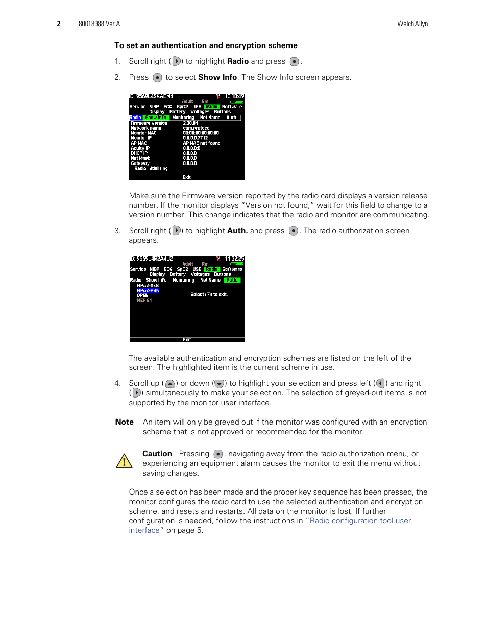 Welch Allyn Propaq LT Monitor Radio Configuration - Quick Reference Guide User Manual | Page 2 / 8