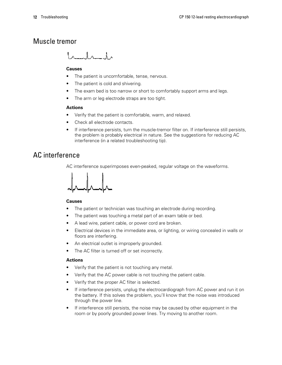 Muscle tremor, Ac interference | Welch Allyn CP150 12-Lead Resting Electrocardiograph, Software Version 2.00.XX - Quick Reference Guide User Manual | Page 14 / 16