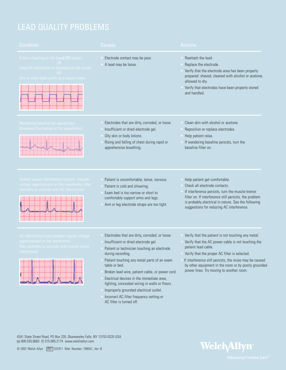 Lead quality problems | Welch Allyn Cardio Perfect Exercise ECG Quick Start Guide - Quick Reference Guide User Manual | Page 6 / 6