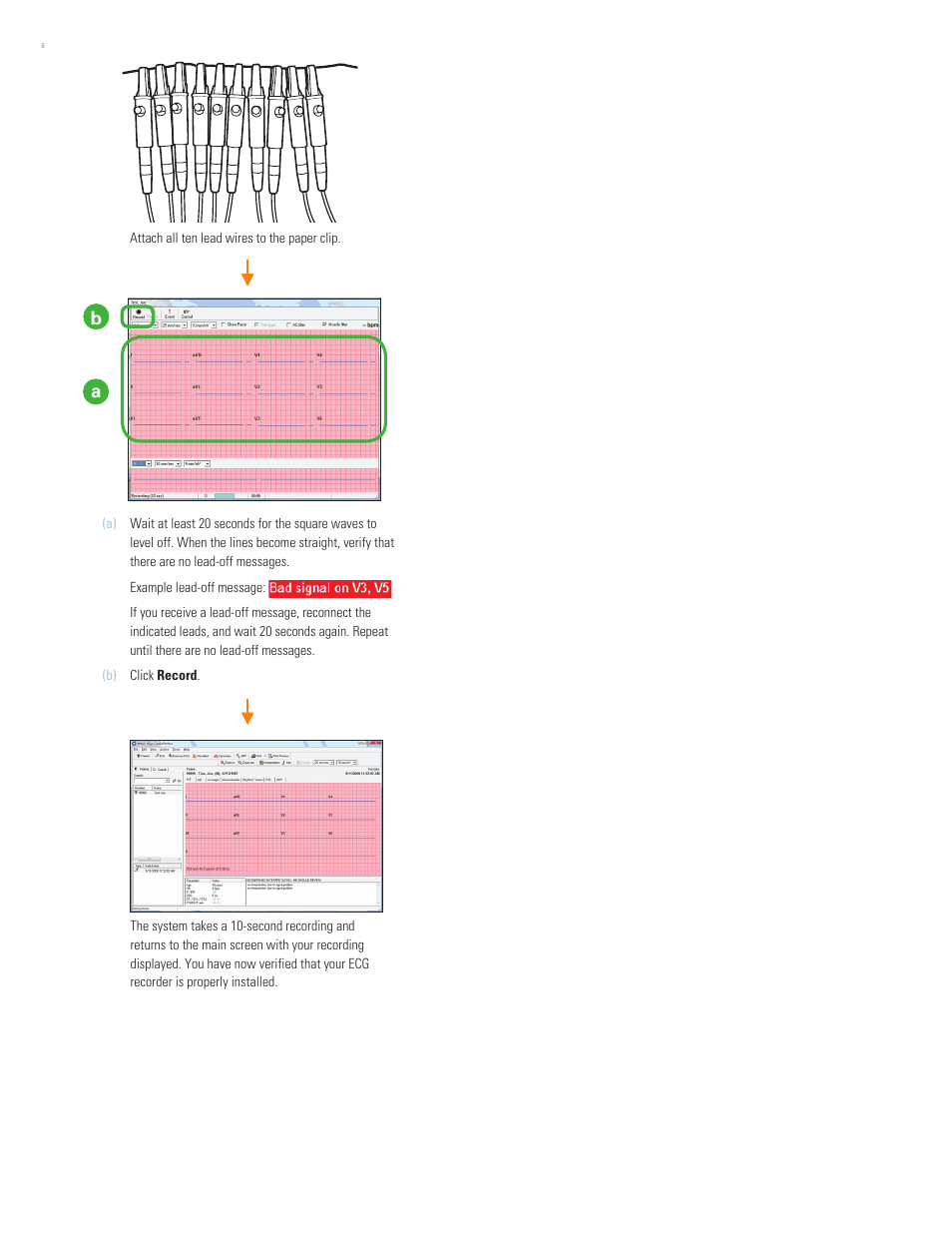 Welch Allyn CardioPerfect Workstation 1.6.5 Software Self Installation - Quick Reference Guide User Manual | Page 6 / 12