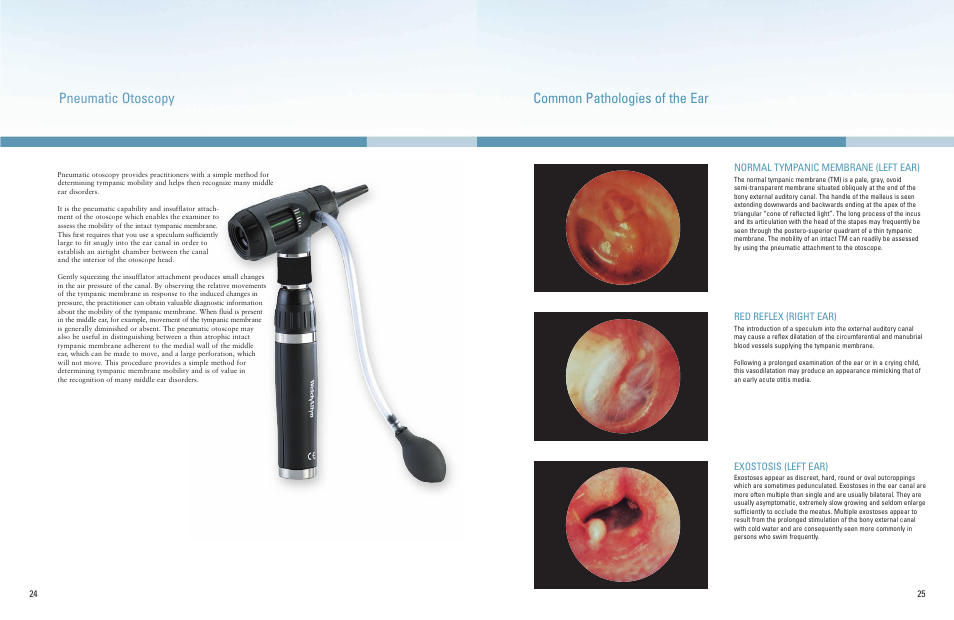 Pneumatic otoscopy, Common pathologies of the ear | Welch Allyn A Guide To The Use Of Diagnostic Instruments In Eye And Ear Examinations - Quick Reference Guide User Manual | Page 13 / 16