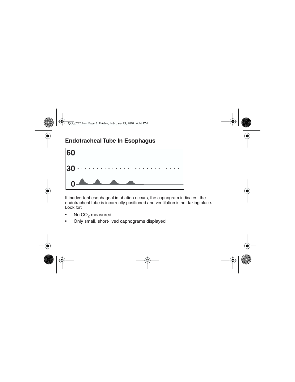 Welch Allyn Propaq Quick Start Guide For Co2 Waveforms - Quick Reference Guide User Manual | Page 3 / 8