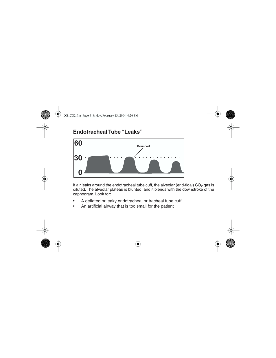 Welch Allyn Propaq Quick Start Guide For Co2 Waveforms - Quick Reference Guide User Manual | Page 4 / 8