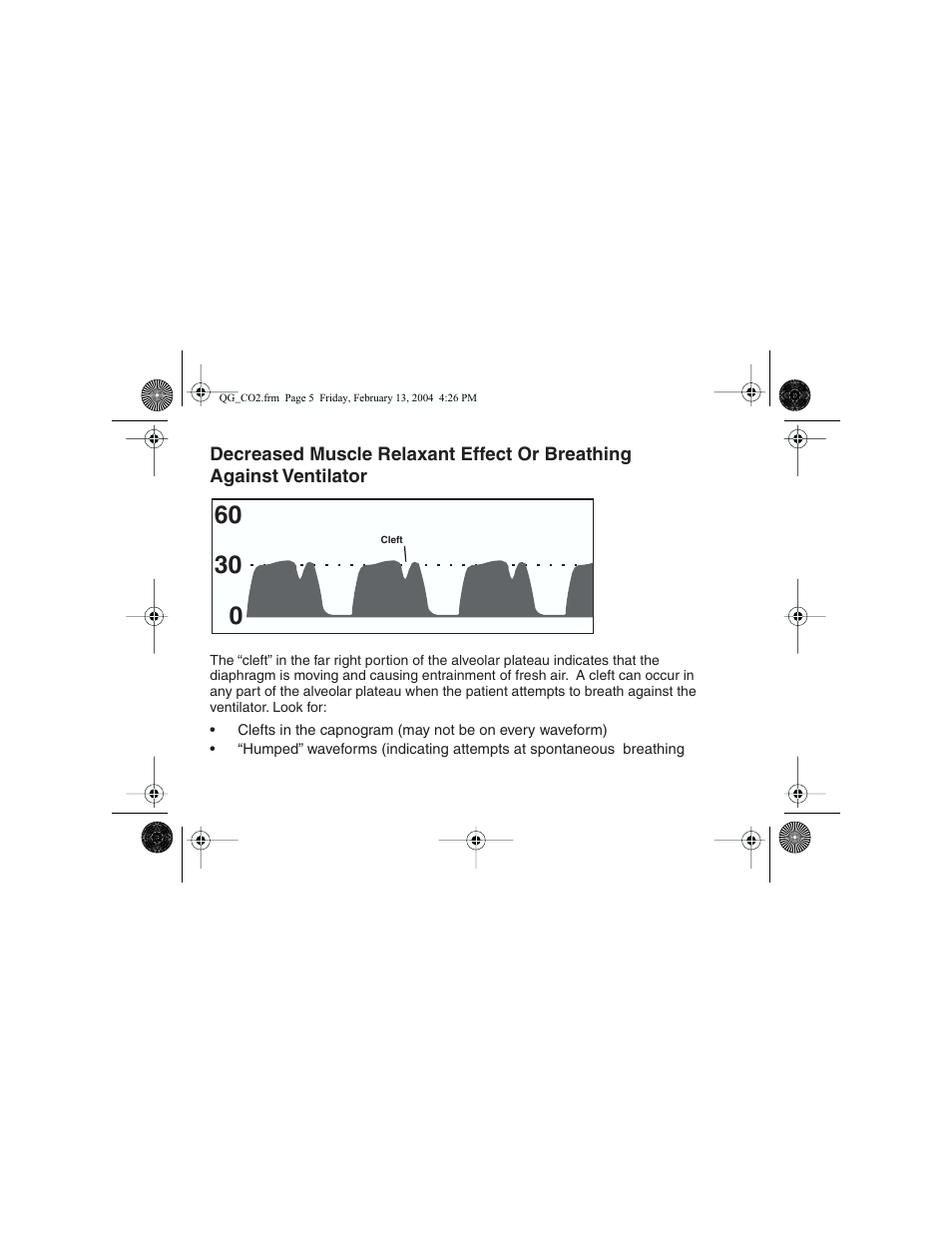 Welch Allyn Propaq Quick Start Guide For Co2 Waveforms - Quick Reference Guide User Manual | Page 5 / 8