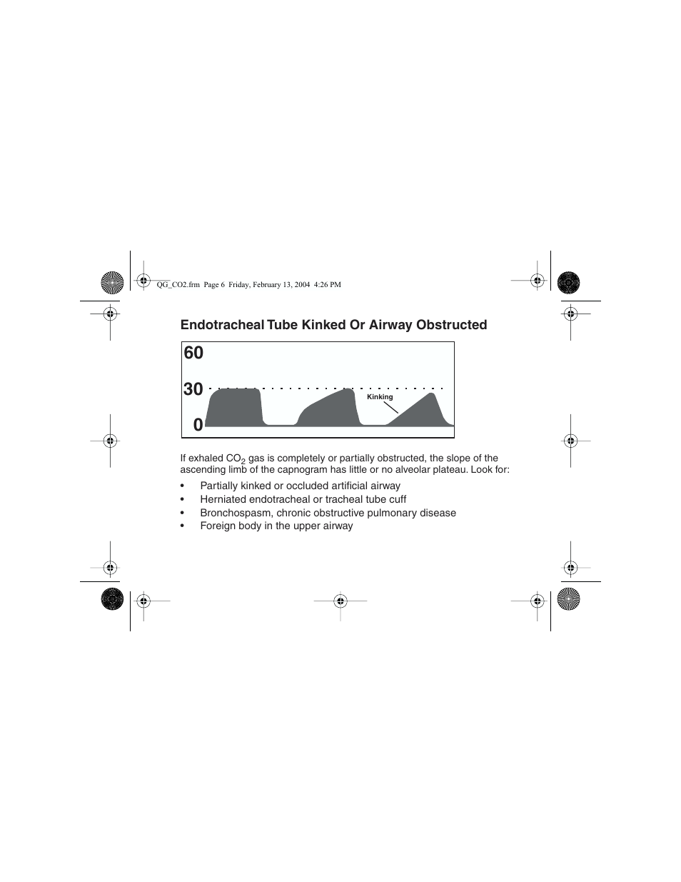 Welch Allyn Propaq Quick Start Guide For Co2 Waveforms - Quick Reference Guide User Manual | Page 6 / 8