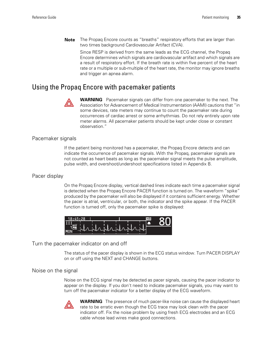 Using the propaq encore with pacemaker patients | Welch Allyn Vital Signs Monitor, Propaq Encore - Quick Reference Guide User Manual | Page 41 / 144