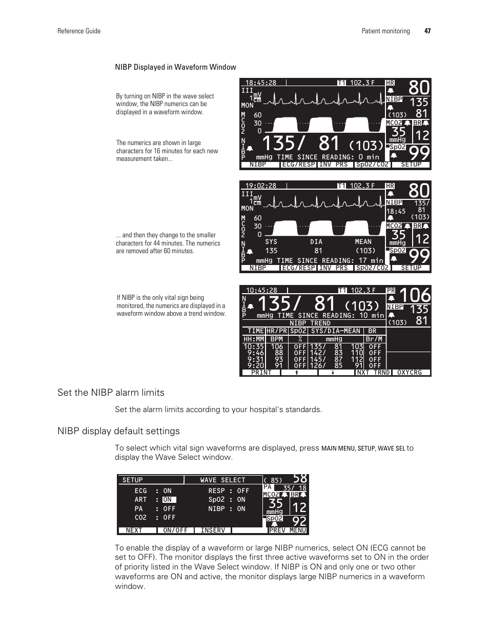 Welch Allyn Vital Signs Monitor, Propaq Encore - Quick Reference Guide User Manual | Page 53 / 144