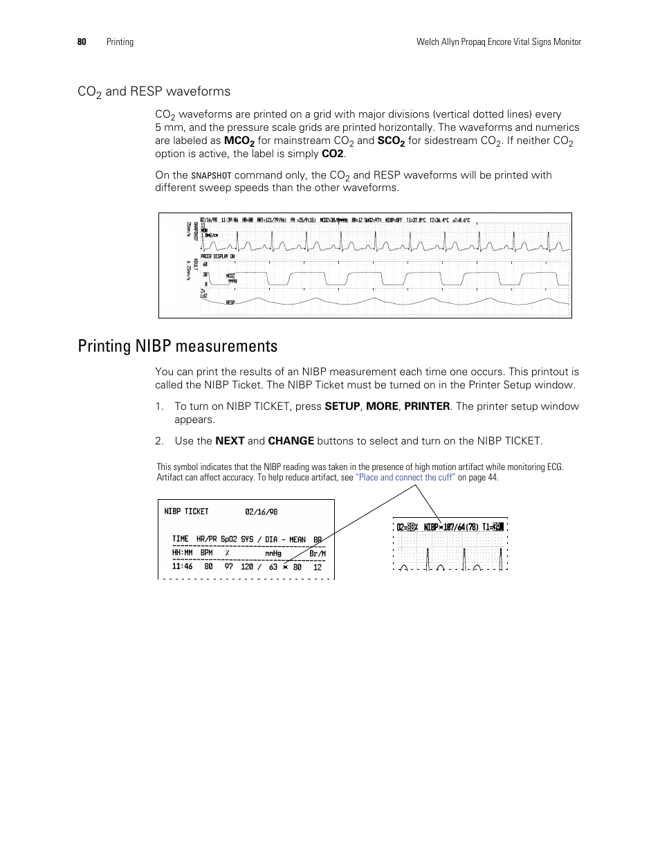 Printing nibp measurements, And resp waveforms | Welch Allyn Vital Signs Monitor, Propaq Encore - Quick Reference Guide User Manual | Page 86 / 144