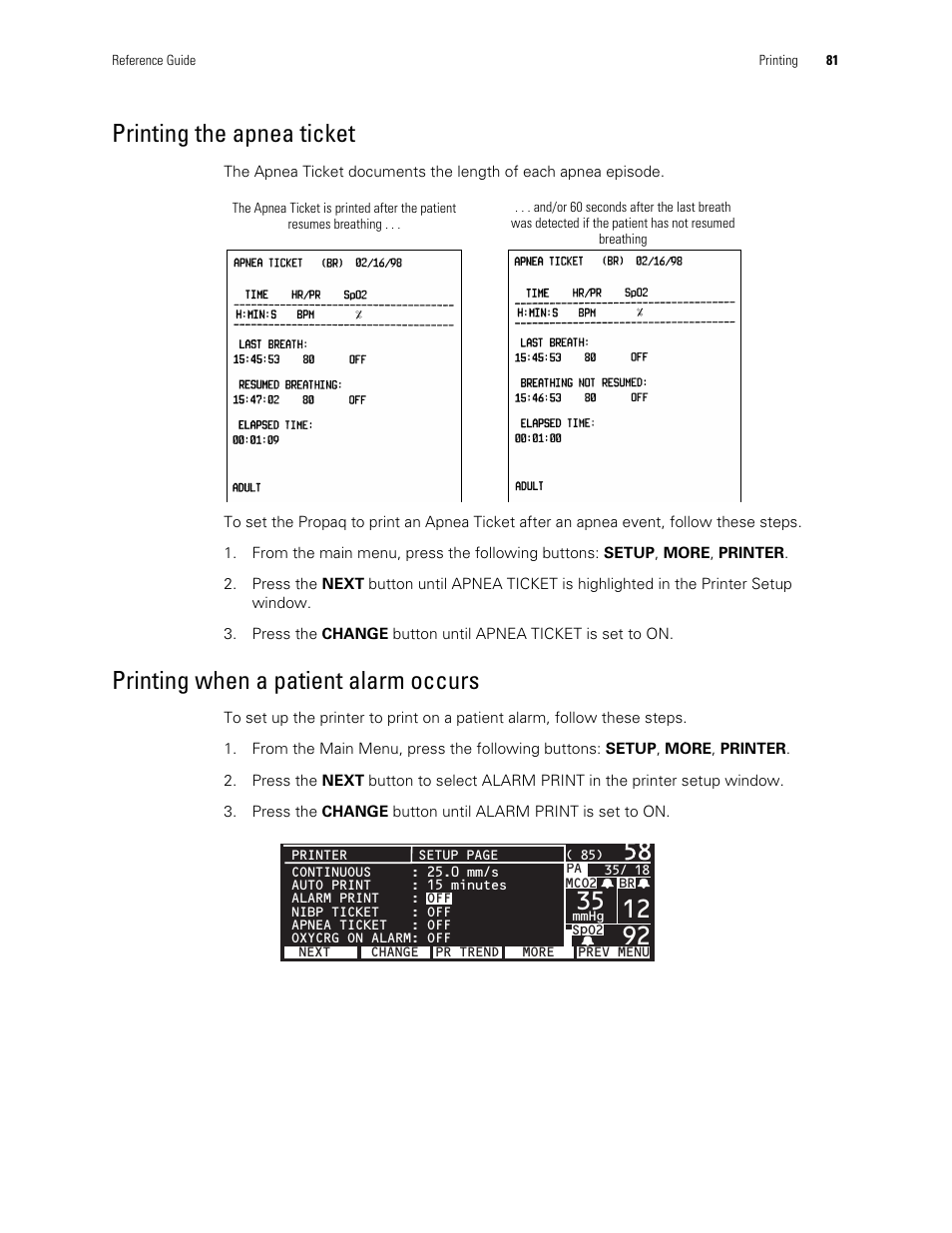 Printing the apnea ticket, Printing when a patient alarm occurs | Welch Allyn Vital Signs Monitor, Propaq Encore - Quick Reference Guide User Manual | Page 87 / 144