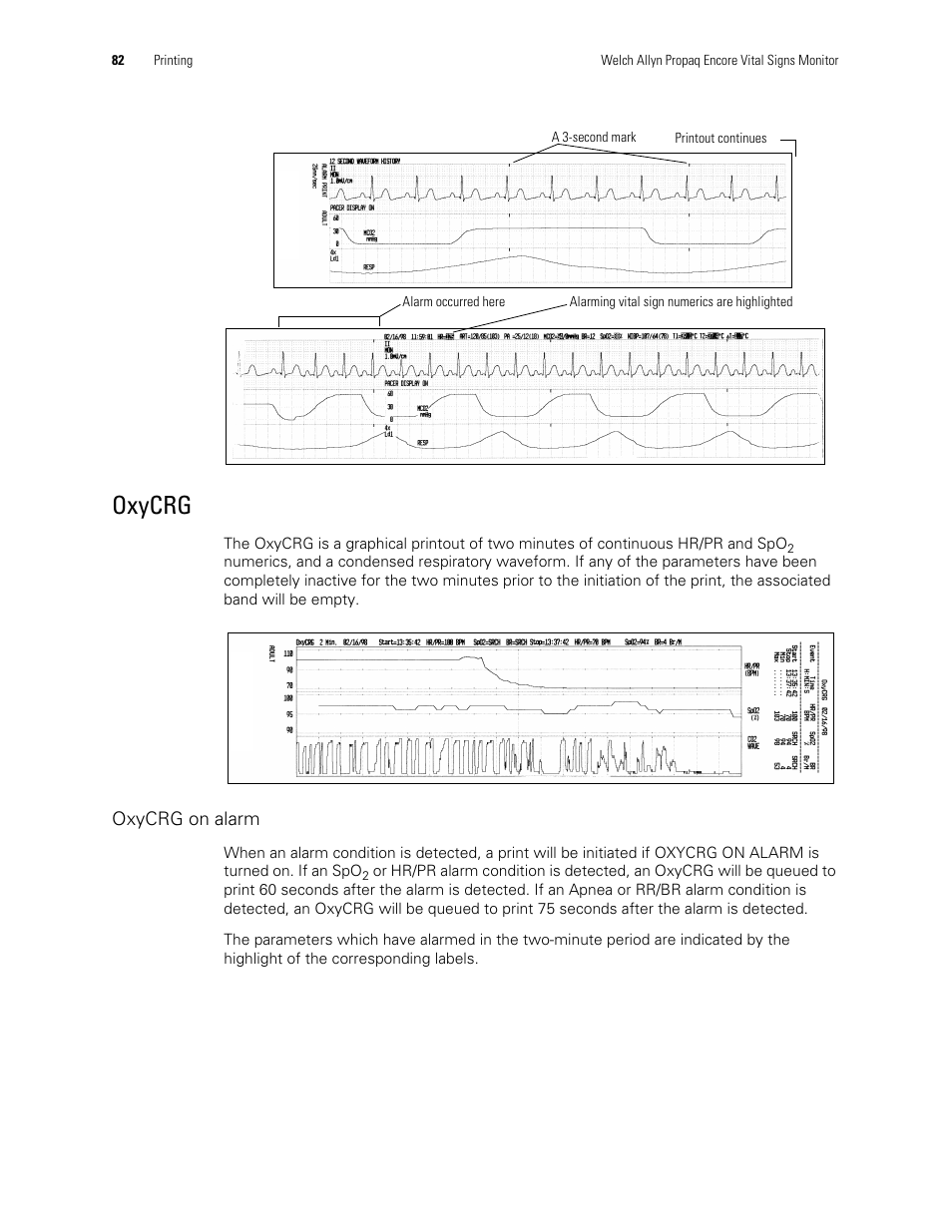 Oxycrg | Welch Allyn Vital Signs Monitor, Propaq Encore - Quick Reference Guide User Manual | Page 88 / 144