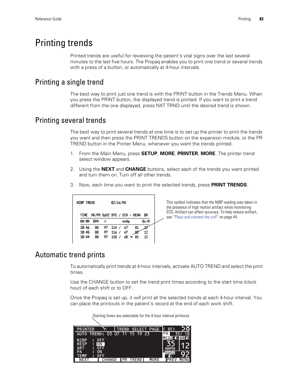 Printing trends, Printing a single trend, Printing several trends | Automatic trend prints | Welch Allyn Vital Signs Monitor, Propaq Encore - Quick Reference Guide User Manual | Page 89 / 144