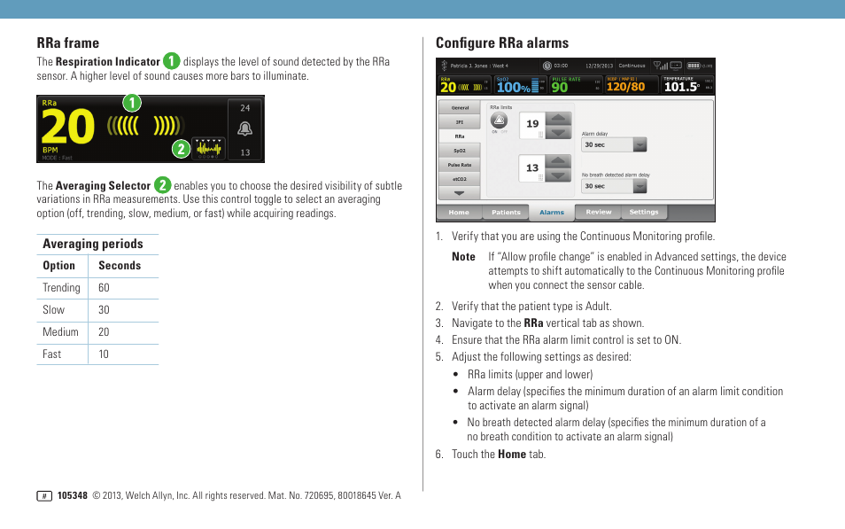 Rra frame, Configure rra alarms | Welch Allyn Connex Vital Signs Monitor RRa - Quick Reference Guide User Manual | Page 2 / 2