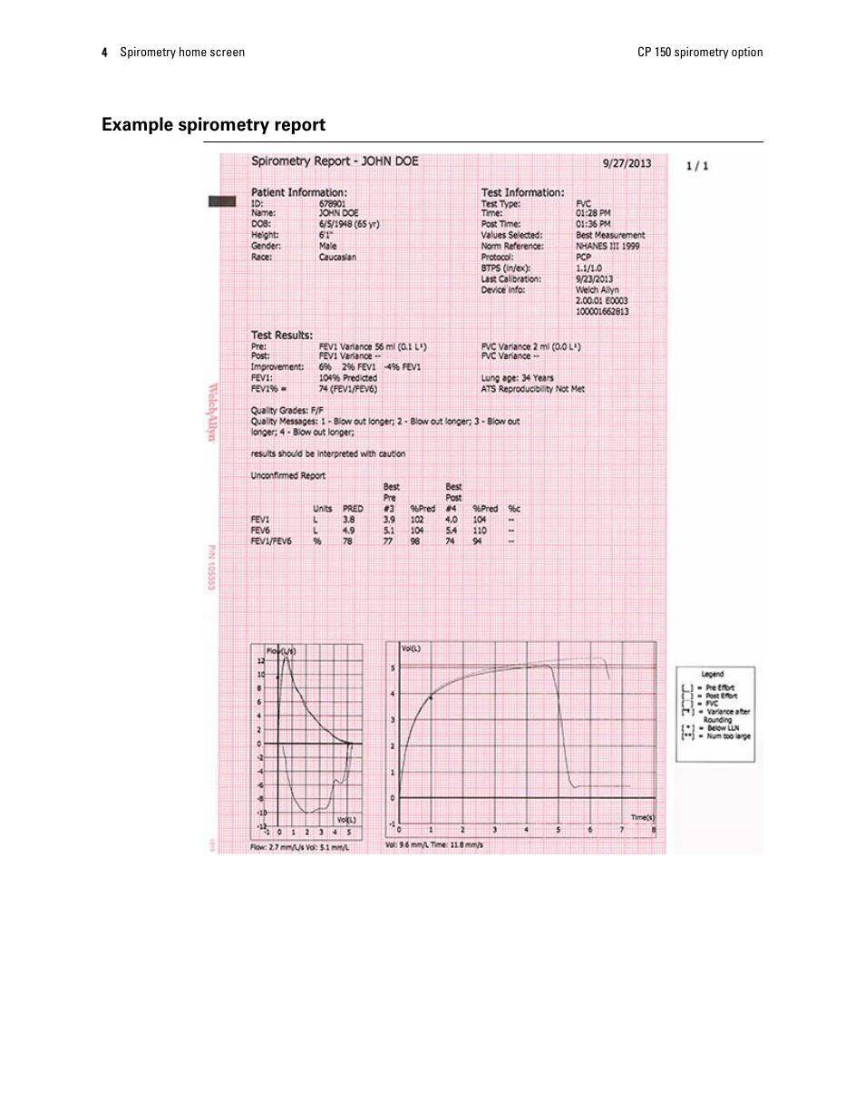 Example spirometry report | Welch Allyn CP150 Spirometry - Quick Reference Guide User Manual | Page 6 / 16