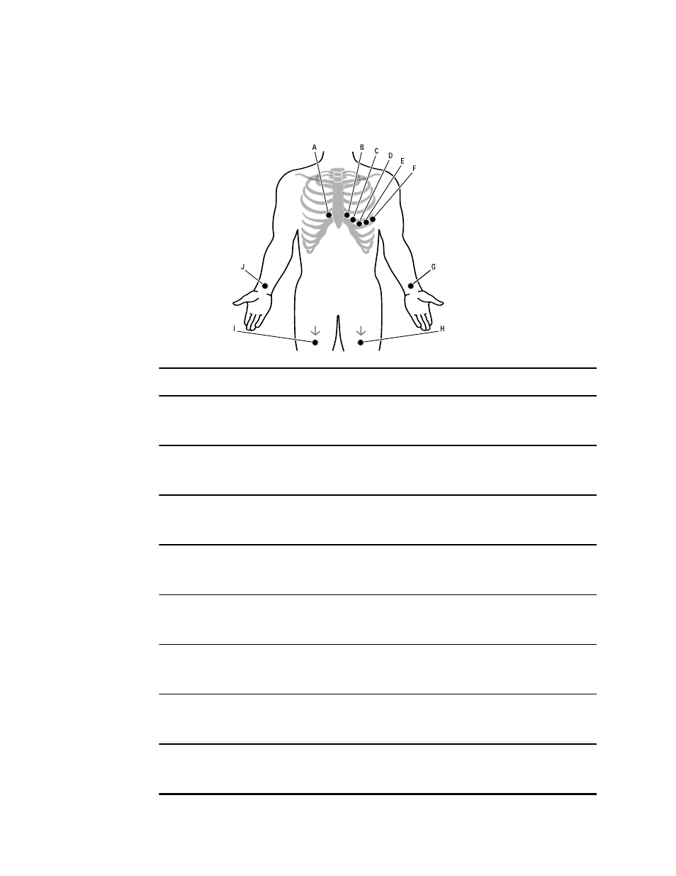 Electrode locations | Welch Allyn CP50 - Quick Reference Guide User Manual | Page 4 / 20