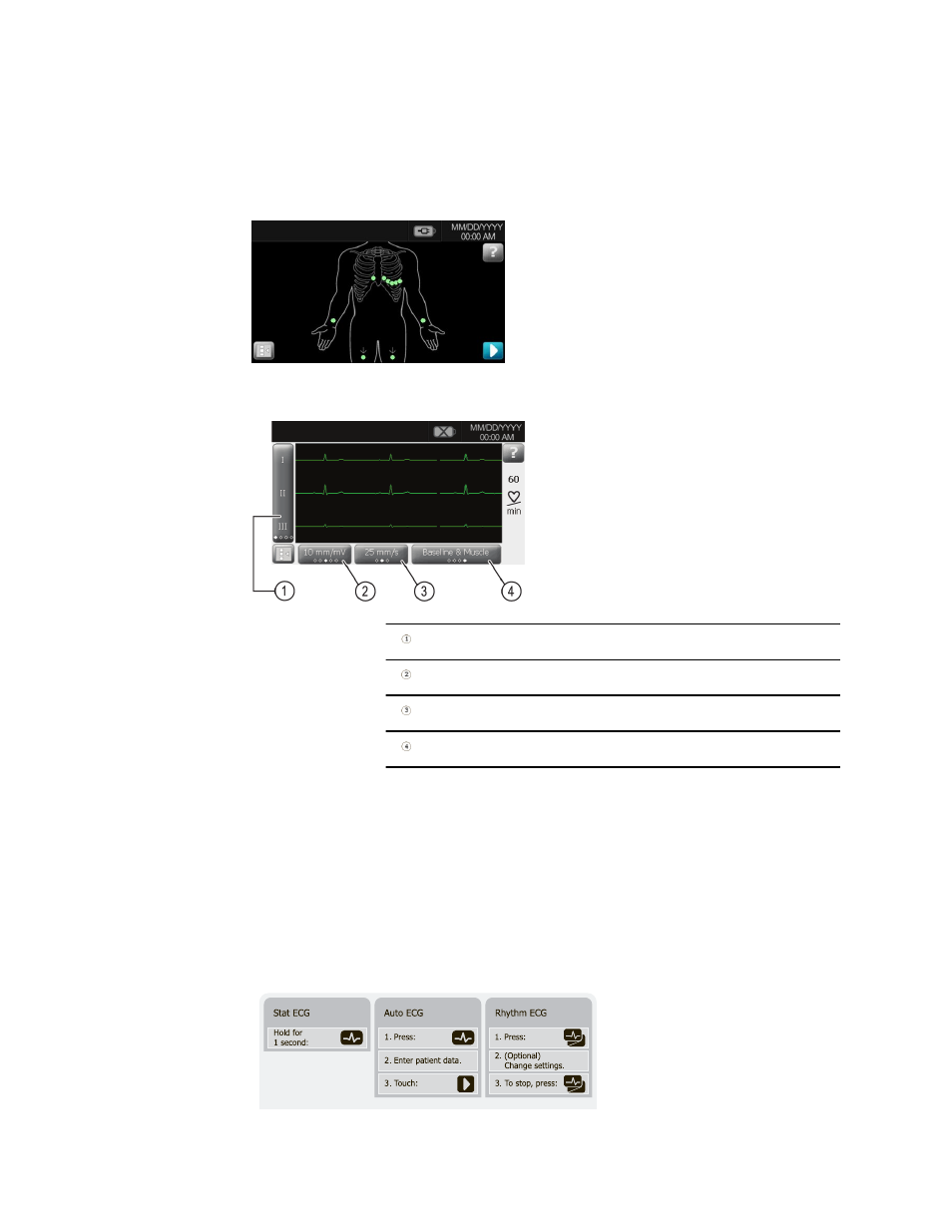 Performing an ecg test | Welch Allyn CP50 - Quick Reference Guide User Manual | Page 7 / 20