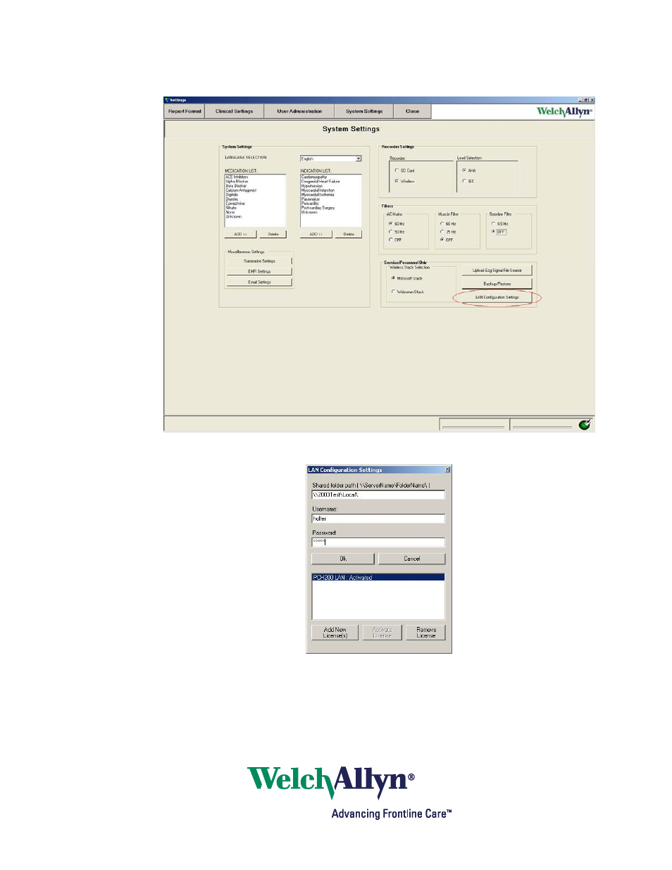 Welch Allyn Holter Software PCH100 and PCH200, LAN - Installation Guide User Manual | Page 11 / 17