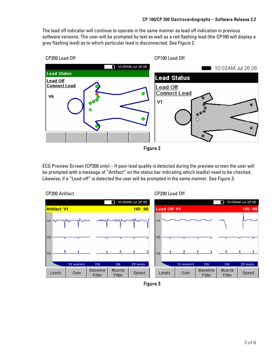 Welch Allyn CP100 And CP200 Software Upgrade Instructions - Installation Guide User Manual | Page 3 / 8
