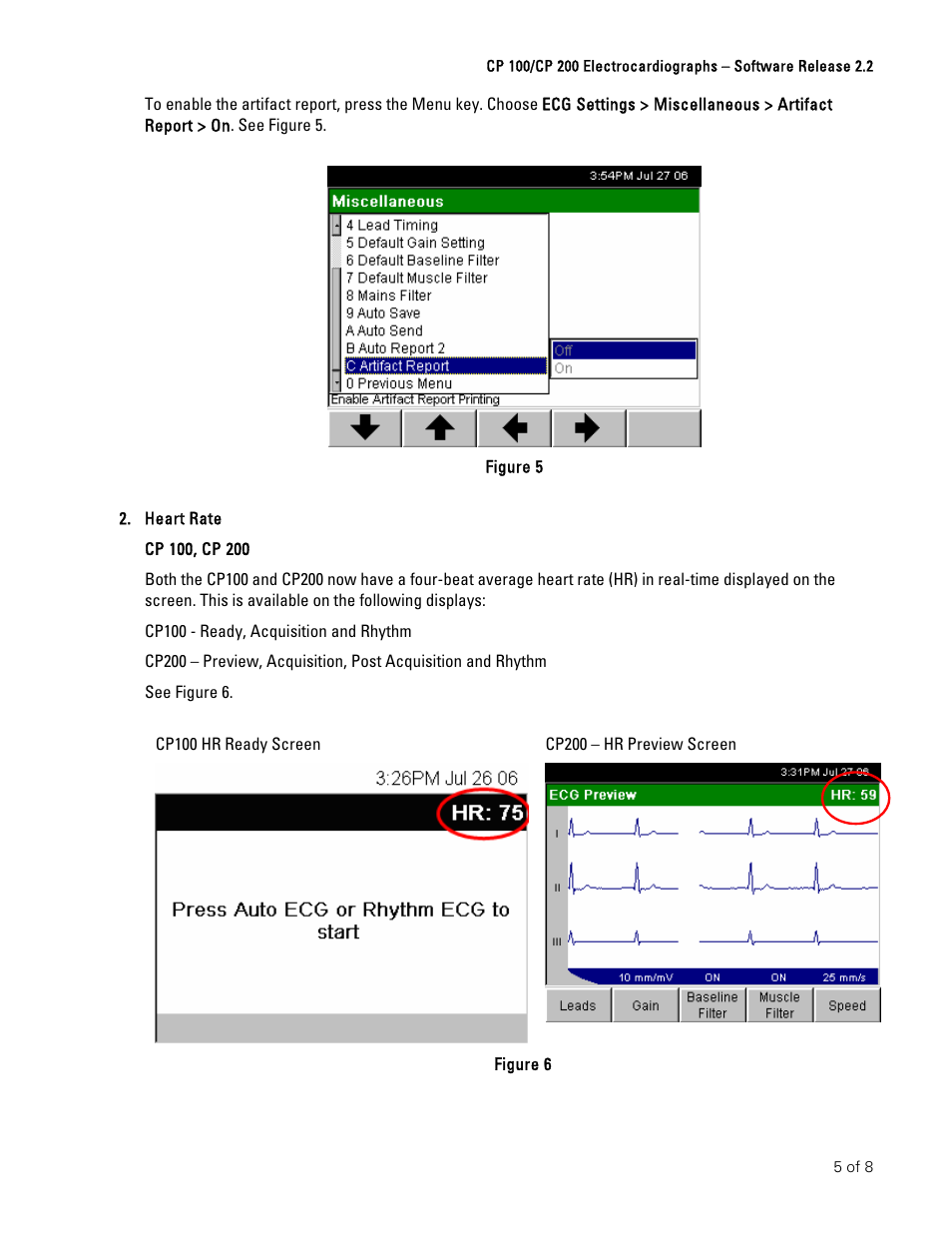 Welch Allyn CP100 And CP200 Software Upgrade Instructions - Installation Guide User Manual | Page 5 / 8