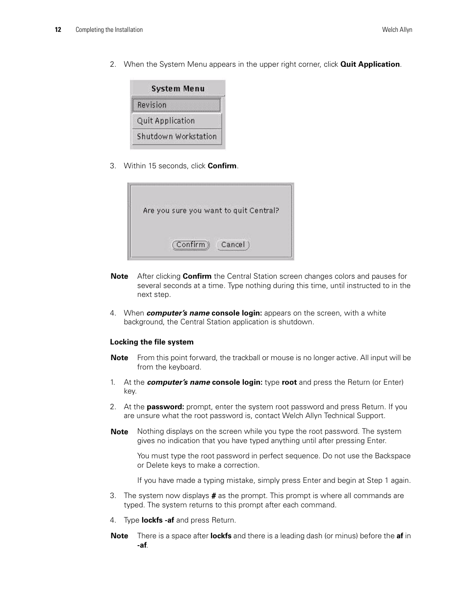 Welch Allyn Acuity Software Upgrade CD - Installation Guide User Manual | Page 16 / 28