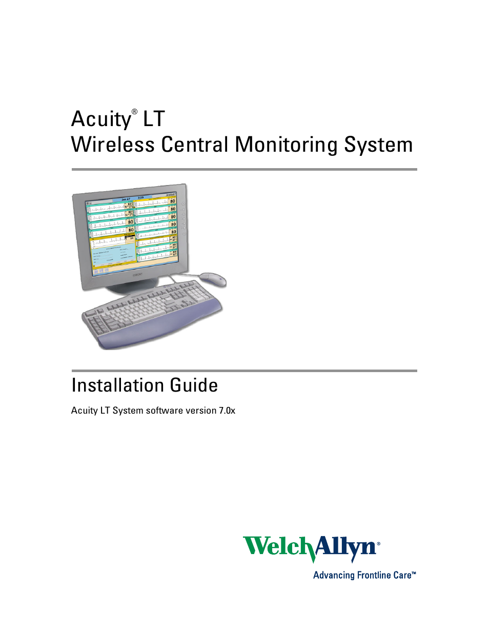Welch Allyn Acuity LT Mobile - Installation Guide User Manual | 64 pages