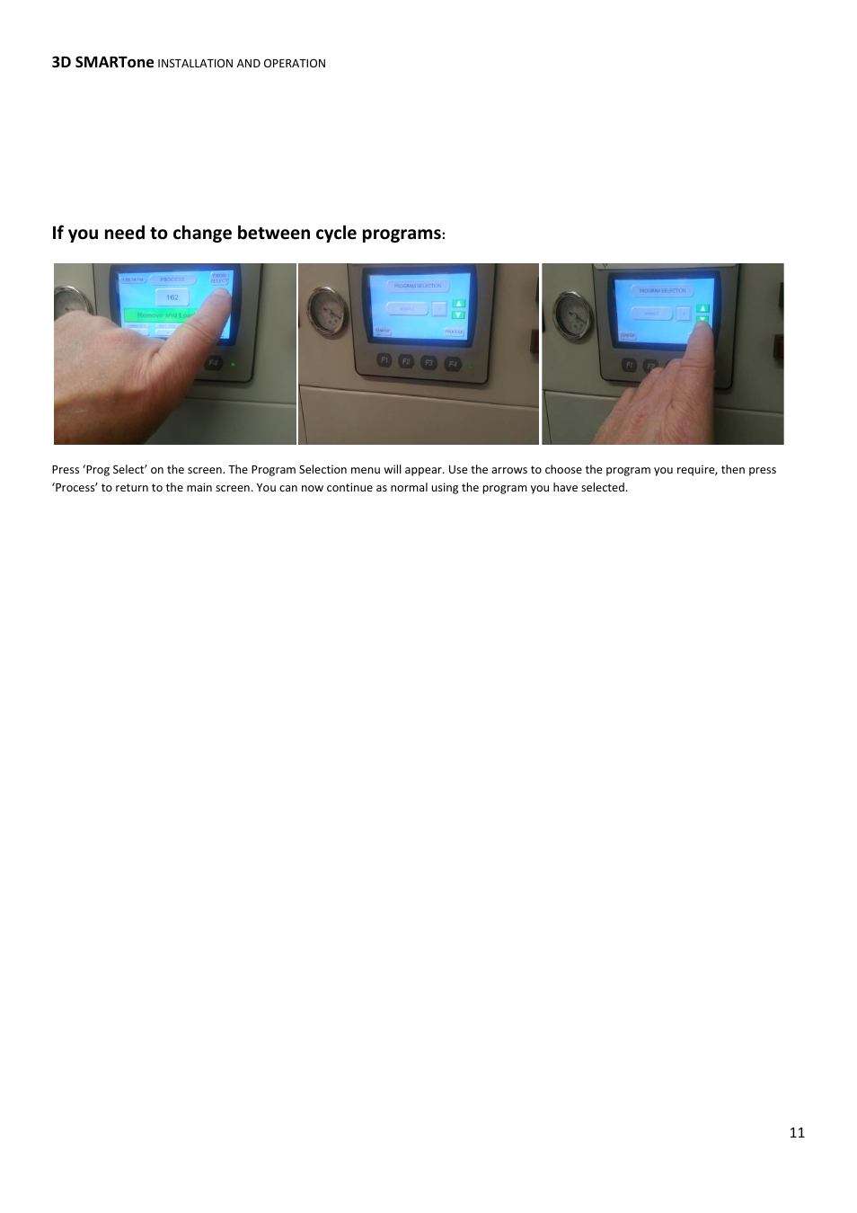 If you need to change between cycle programs | Xpres 3D SMARTone User Manual | Page 11 / 25