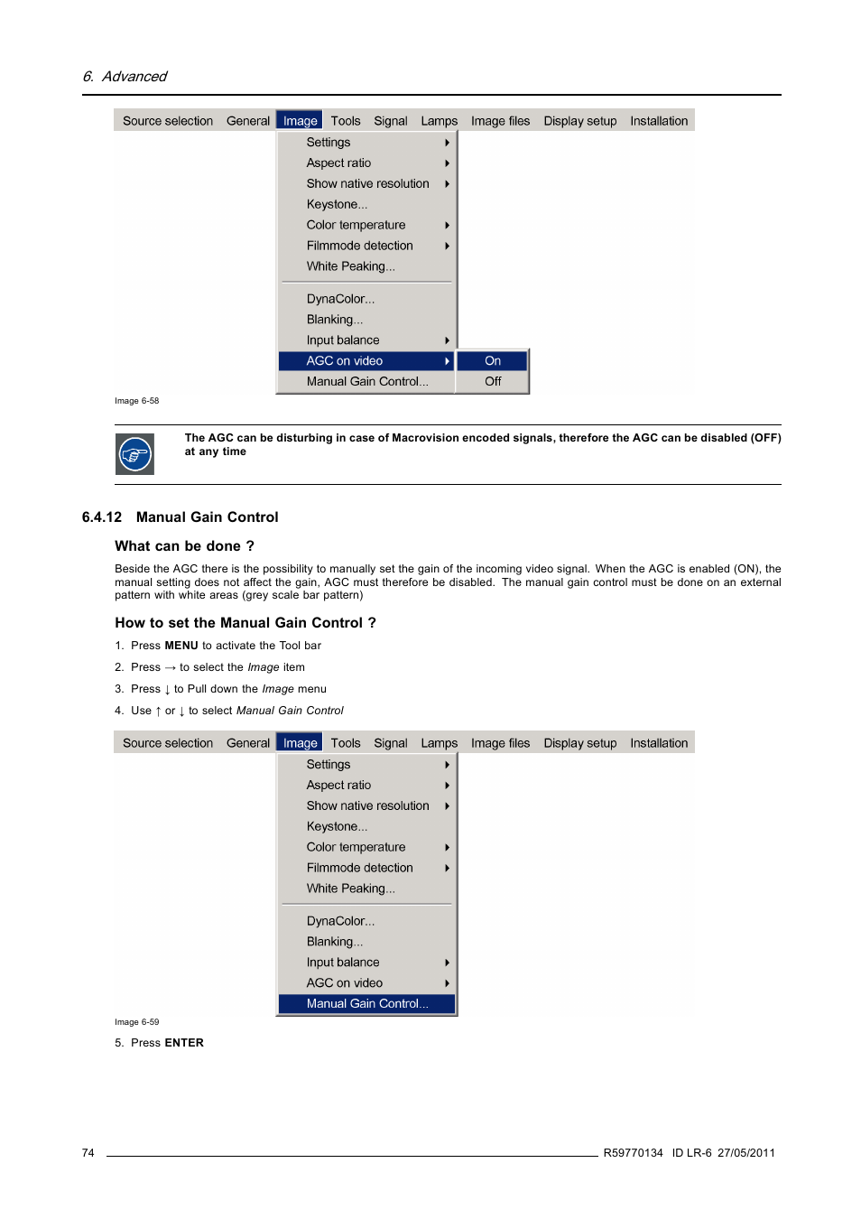 12 manual gain control, Manual gain control, Advanced | Barco ID LR-6 R9010342 User Manual | Page 78 / 135