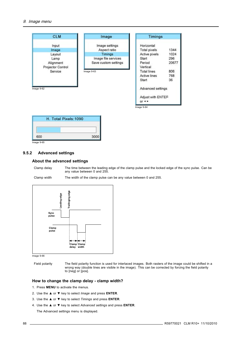 2 advanced settings, Advanced settings, Image 9-62, image 9-63, image 9-64 | Image 9-65, Image menu, 2 advanced settings about the advanced settings, How to change the clamp delay - clamp width | Barco CLM R10+ User Manual | Page 92 / 229