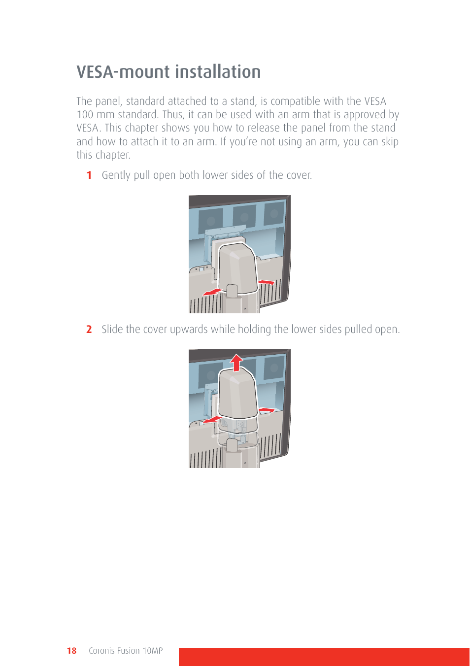Vesa-mount installation | Barco Coronis Fusion 10MP User Manual | Page 18 / 80