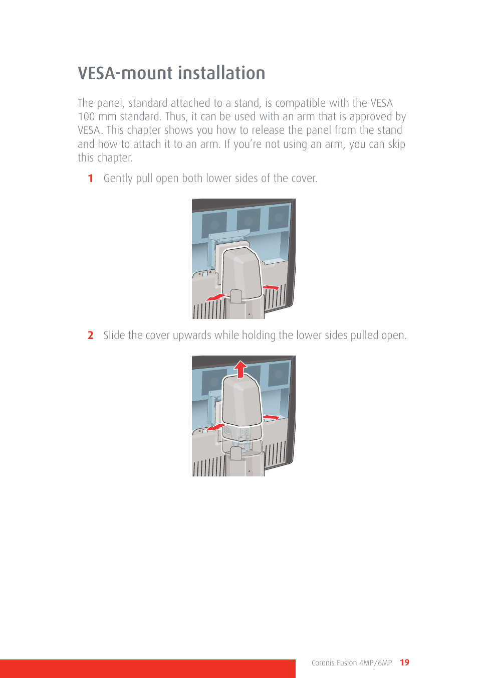 Vesa-mount installation | Barco CORONIS FUSION 4MP/6MP User Manual | Page 19 / 72