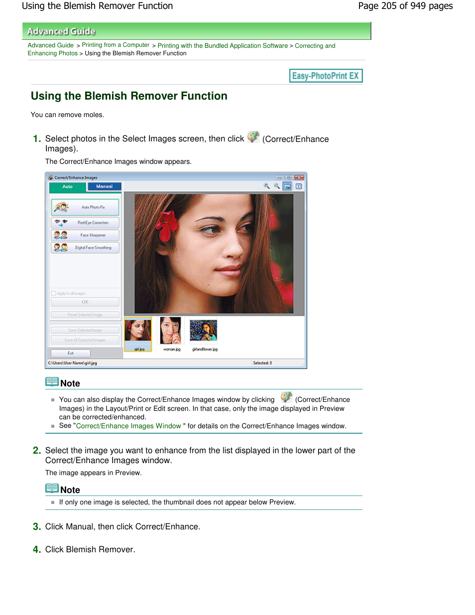 Using the blemish remover function | Canon PIXMA MP560 User Manual | Page 205 / 949
