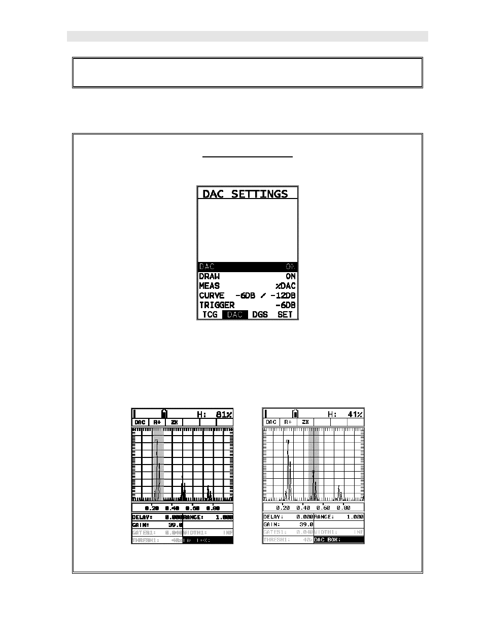 Checkline DFX-7 User Manual | Page 67 / 139