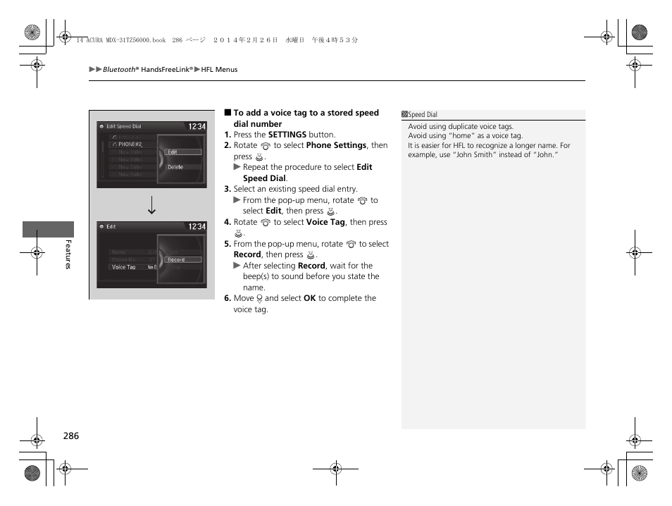 Acura 2014 MDX - Owner's Manual User Manual | Page 287 / 501