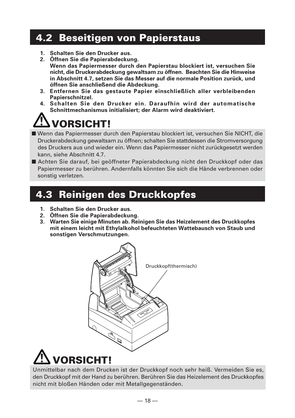 2 beseitigen von papierstaus, 3 reinigen des druckkopfes, Vorsicht | 3 reinigen des druckkopfes vorsicht | CITIZEN CT-S4000DC User Manual | Page 73 / 136