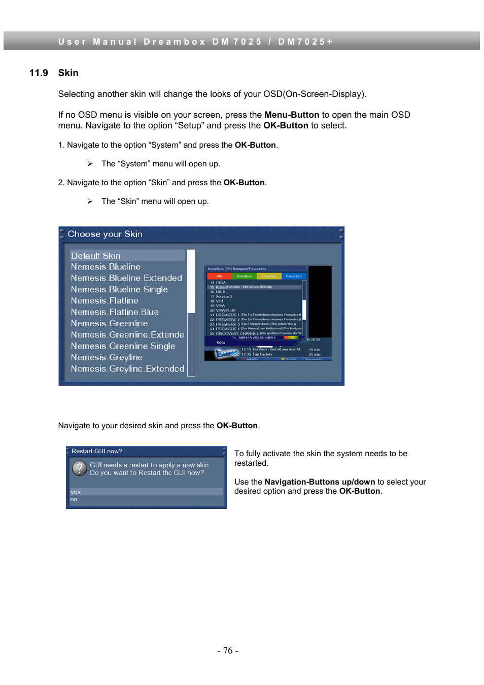 9 skin | Dream Property DM7025 + User Manual | Page 76 / 114