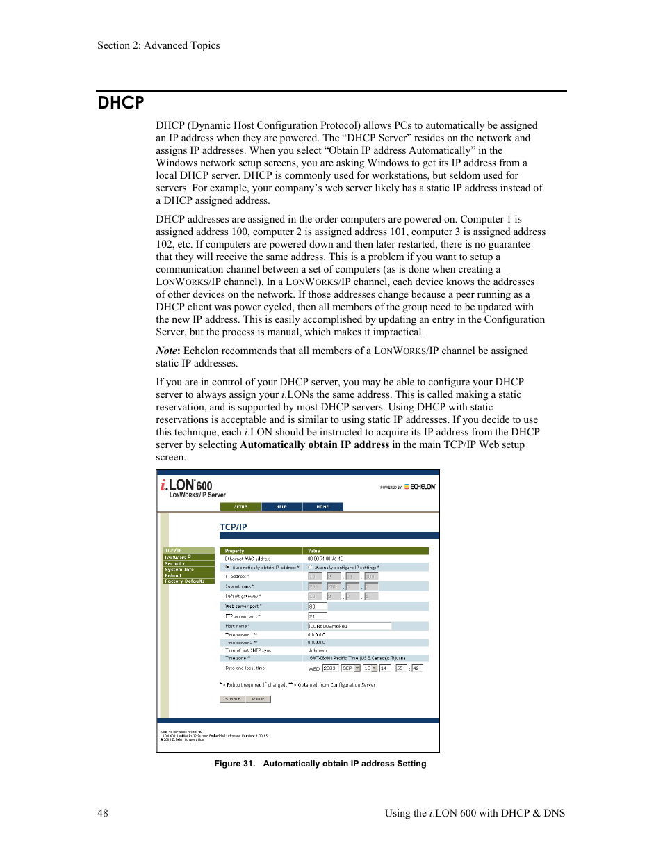 Dhcp | Echelon i.LON 600 LonWorks/IP Server User Manual | Page 56 / 116