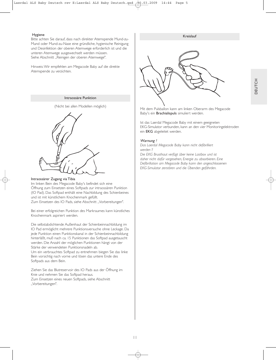 Laerdal ALS Baby User Manual | Page 11 / 40